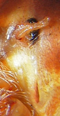 epigyne epigyne